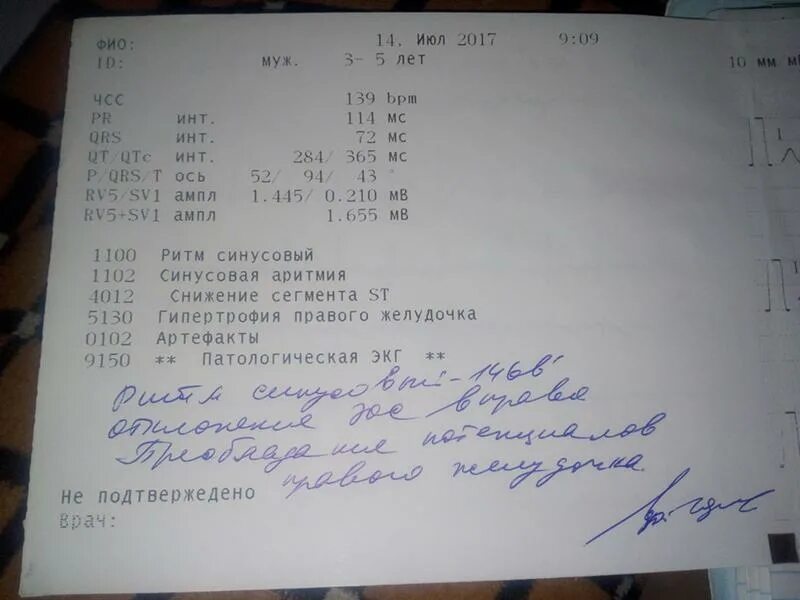 Норма экг у взрослых заключение. Заключение экг. нормальное заключение экг. экг заключение норма у детей. экг врачебное заключение.