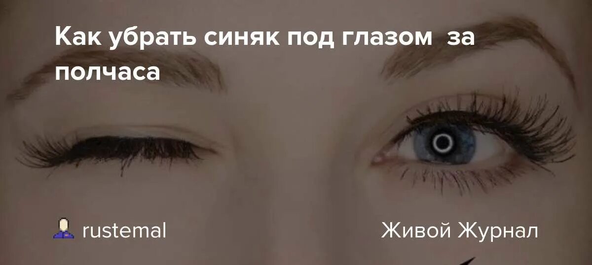 Как быстро убрать синяк с лица. Как убрать синяки под глазами от удара. как быстро избавиться от синяка. как убрать синяк за 5 минут. как быстрей избавится от синека.