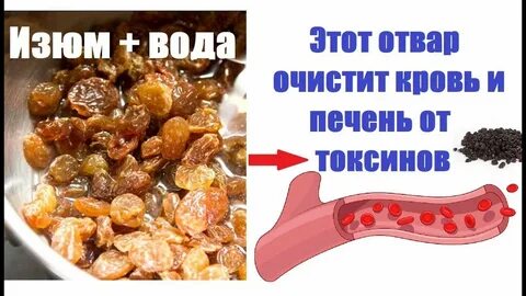Лечение водой печень