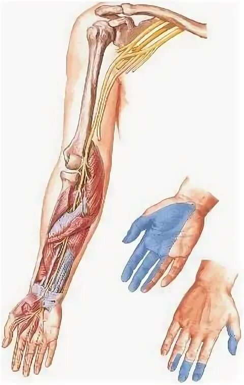 Нейропатия кисти. Неврит (невропатия) локтевого нерва.. Неврит периферических нервов конечностей. Невропатия лучевого нерва анатомия.