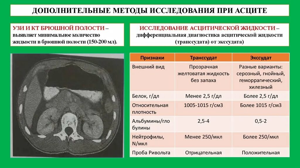 Кт жидкость в брюшной полостт. Жидкость в брюшной полости на кт. Объем жидкости в брюшной полости по УЗИ. УЗИ оценка количества жидкости в брюшной полости. Нормы органов брюшной полости