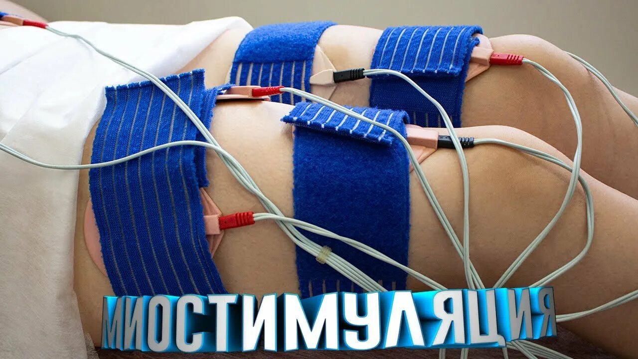 Электростимуляция мышц. Электростимуляция шеи. миостимуляция поясницы. миоритм электростимуляция мышц. миостимуляция мышц спины.