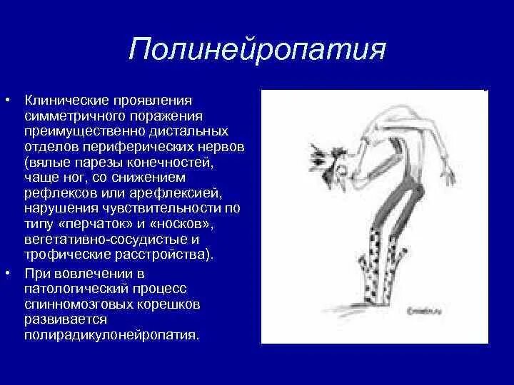 Полинейропатия клинические проявления. Полинейропатия верхних и нижних. Полиневропатия верхних и нижних конечностей. Полинейропатия нижних конечностей и верхних конечностей. Заболевание полинейропатия конечностей