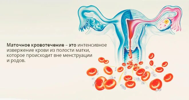 Почему кровь из матки. Обильное кровотечение. Аномальные маточные кровотечения. Обильные месячные при климаксе пременопауза.