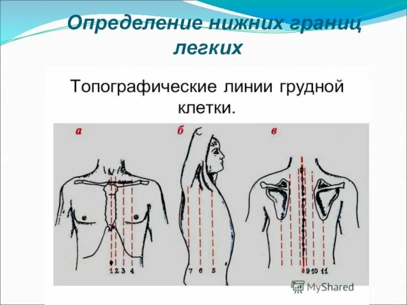 Топографическая перкуссия грудной клетки пропедевтика. Перкуссия нижних границ легких. Границы легких перкуссия. Топографические линии для определения нижней границы легких. Топографическая перкуссия грудной клетки в норме.