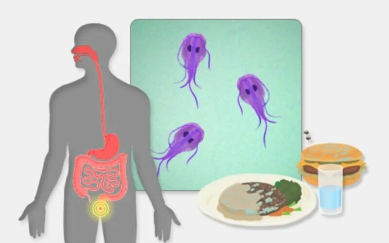 Источник инвазии больной человек. Протозойные инфекции лямблиоз. Протозойные кишечные инфекции лямблиоз. Лямблии источник заражения. Кишечные паразиты лямблии.