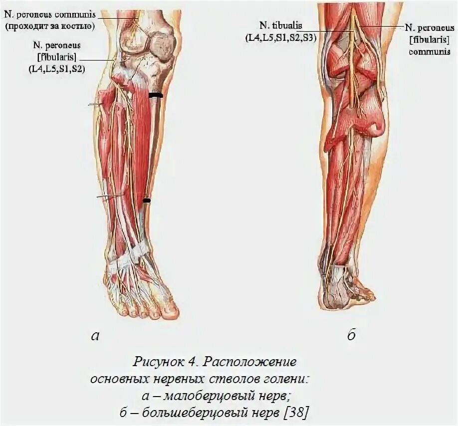 Малоберцовый нерв стопа. Малоберцовый и большеберцовый нервы расположение. Невропатия малоберцового нерва. Невропатия поверхностного малоберцового нерва. Невропатия малоберцового нерва и большеберцового нерва.