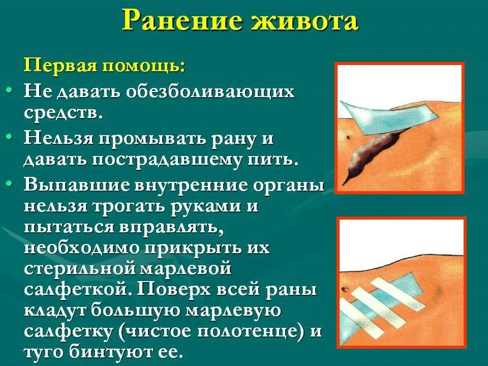 Повреждение причиненное ударом. Первая помощь при Раении живот. Первая помощь при ранении живота. Оказание первой помощи при ранении живота. Первая помошт при ранение дивота.