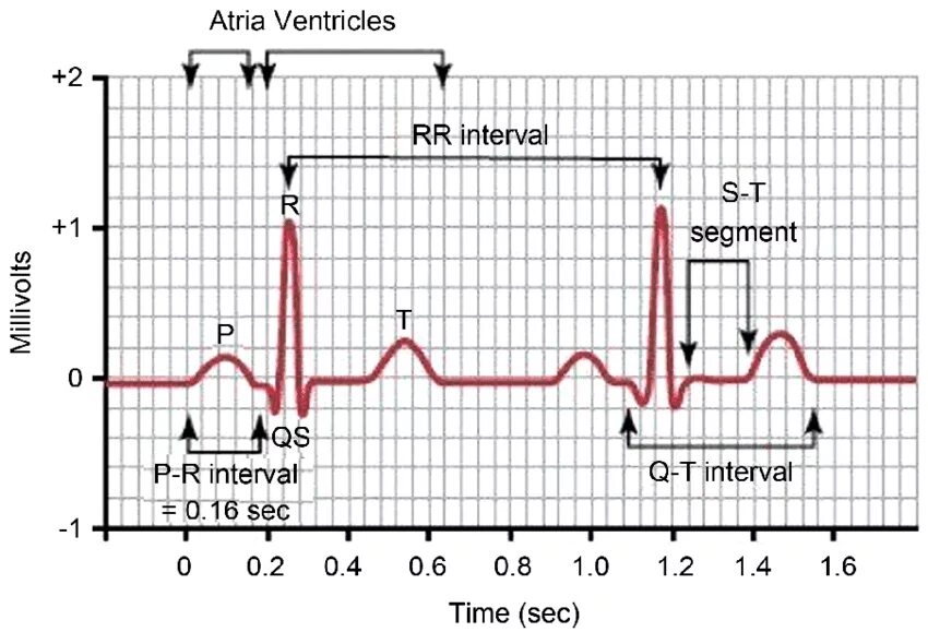 Интервал pr. Normal ECG. Интервал PR на ЭКГ. Электрокардиография normal. Normal ECG Wave.