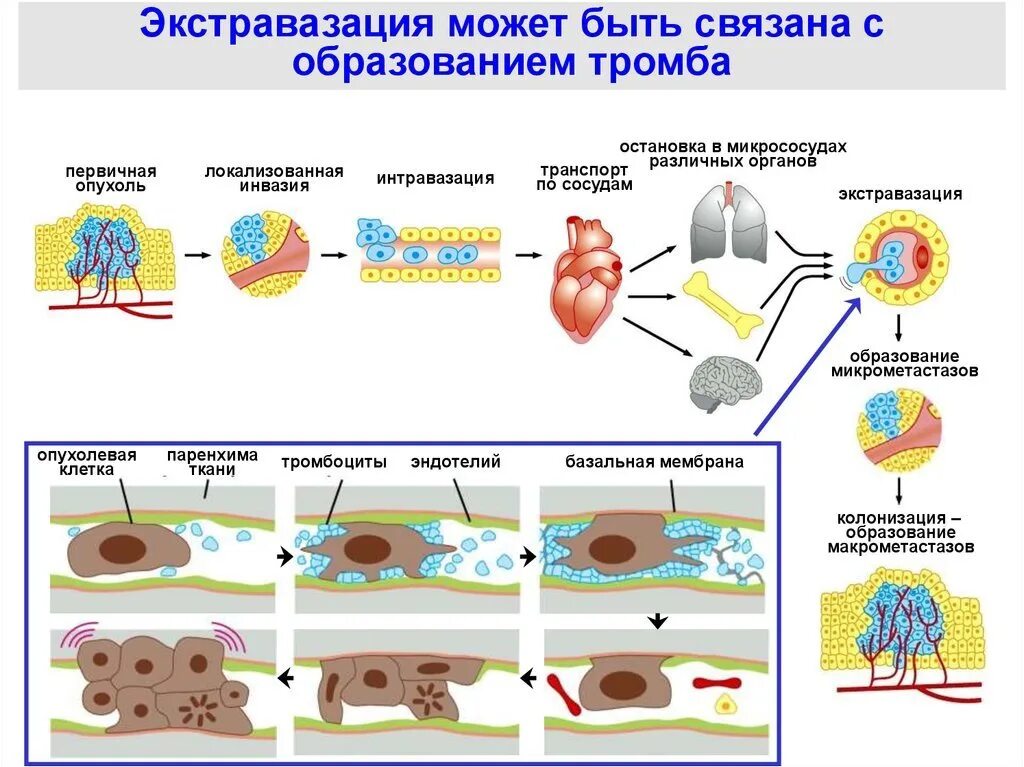 Что такое экстравазация