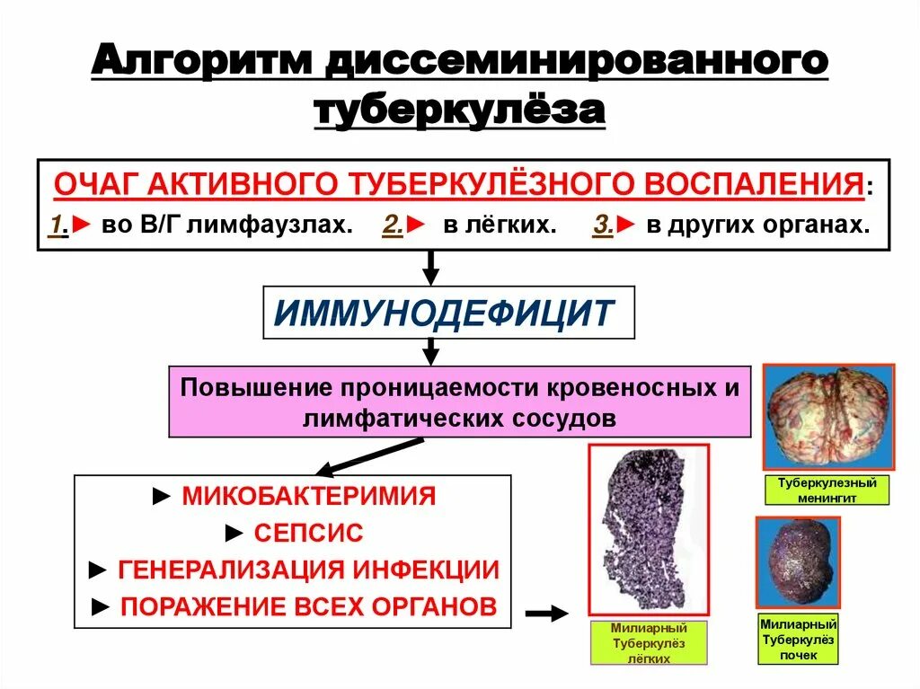 Диссеминированный туберкулёз лёгких патогенез. Патогенез диссеминированного туберкулеза. Диссеминированный туберкулез этиология. Диссеминированный туберкулез патогенез.