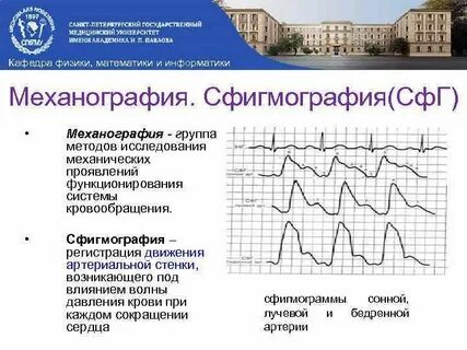 Механография это