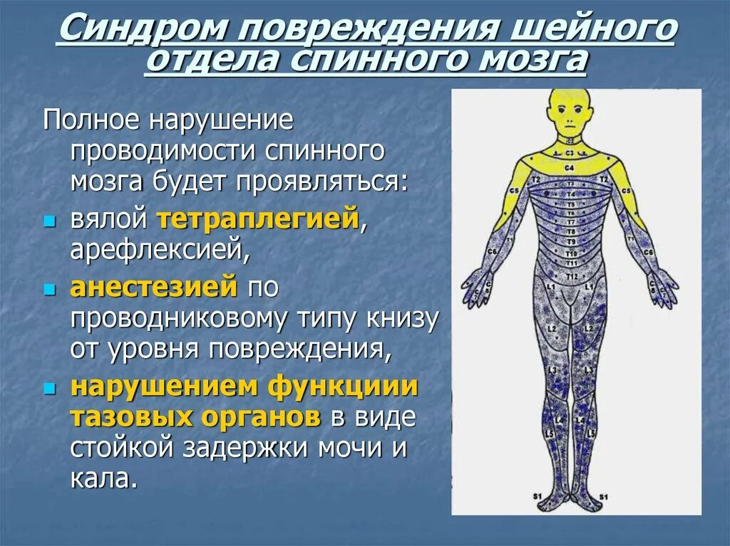 Сотрясение позвоночника. Травма шейного отдела спинного мозга. Повреждение шейного отдела спинного мозга. Клиника осложненной травмы шейного отдела спинного мозга. Травмы головного и спинного мозга.