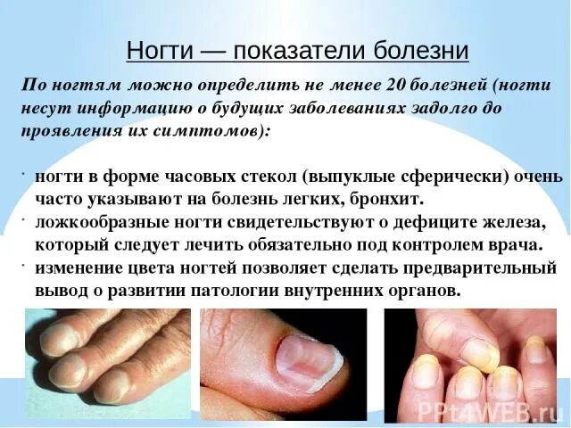 Незаразные заболевания ногтей. Как отличить болезнь