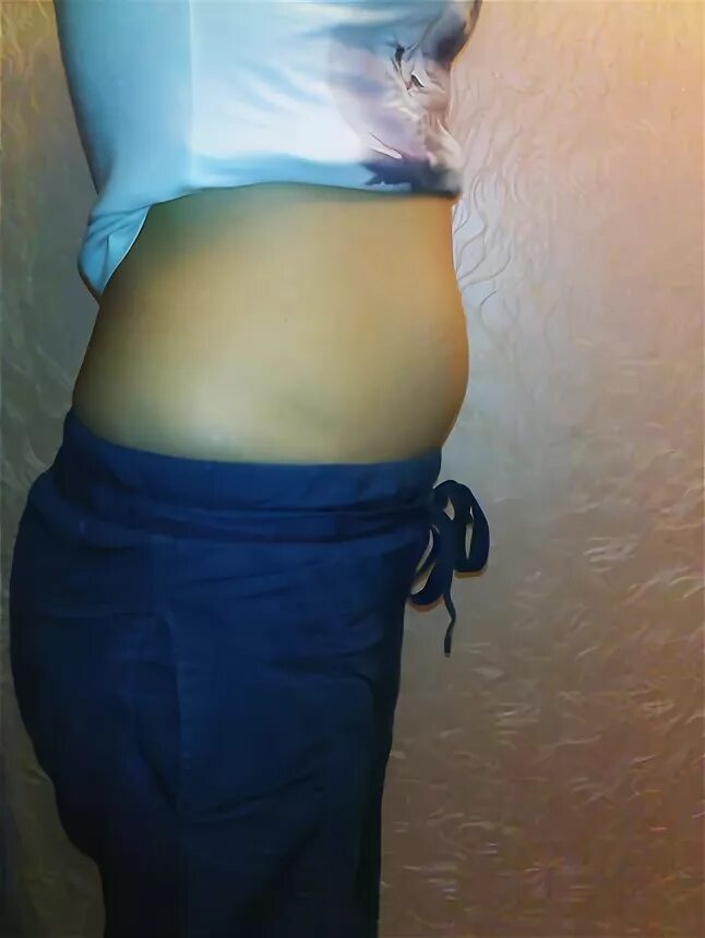 12 недель беременности размер живота. живот на 12 неделе беременности фото. живот на 12 неделе беременности. 12 недель беременности 2 беременность живот. животик на 12 неделе.