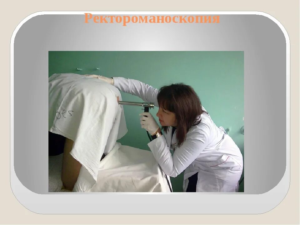Ректороманоскопия при геморрое как выглядит Paraproctitis is acute and chronic. Symptoms Treatment. Photo