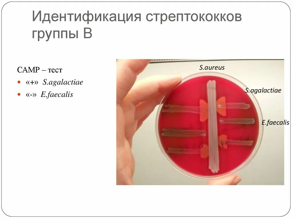 Тест на стрептококки в аптеке. Стрептококки идентификация. Идентификация стрептококков. Идентификация патогенных стрептококков. Тест на стрептококков.