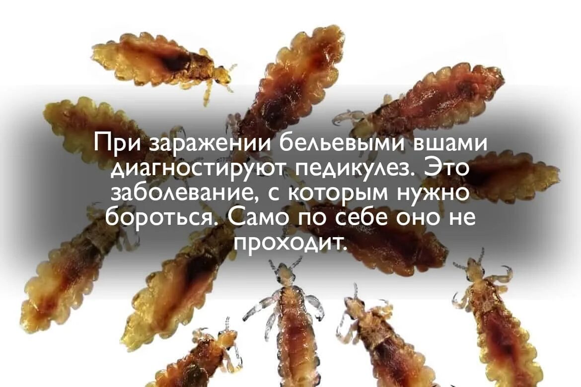 Платяная вошь (pediculus humanus corporis). Как выводят бельевых вшей. Как выводят бельевых вшей. Средство от постельных вшей. Платяная вошь (pediculus humanus corporis).