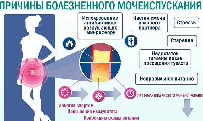 Частое мочеиспускание после тур. Боли после инсоляции мочевого пузыря. Отдает в мочевой пузырь. Профилактическмя лечения в болезни женской мочеворй упзырке.