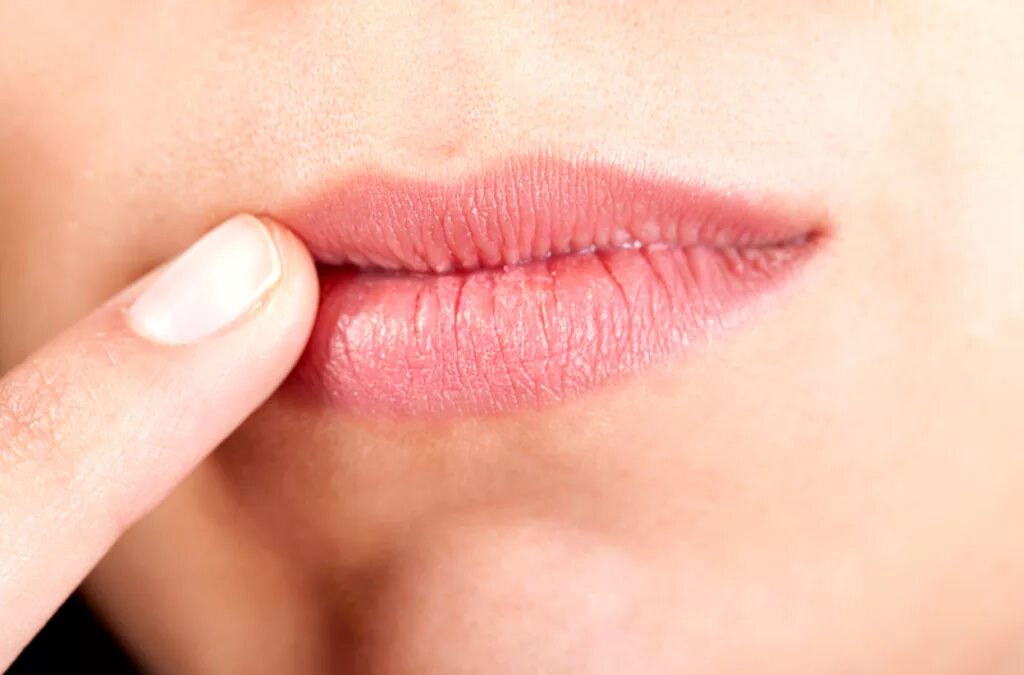 Обветренные губы в домашних условиях. Гиповитаминозный хейлит.