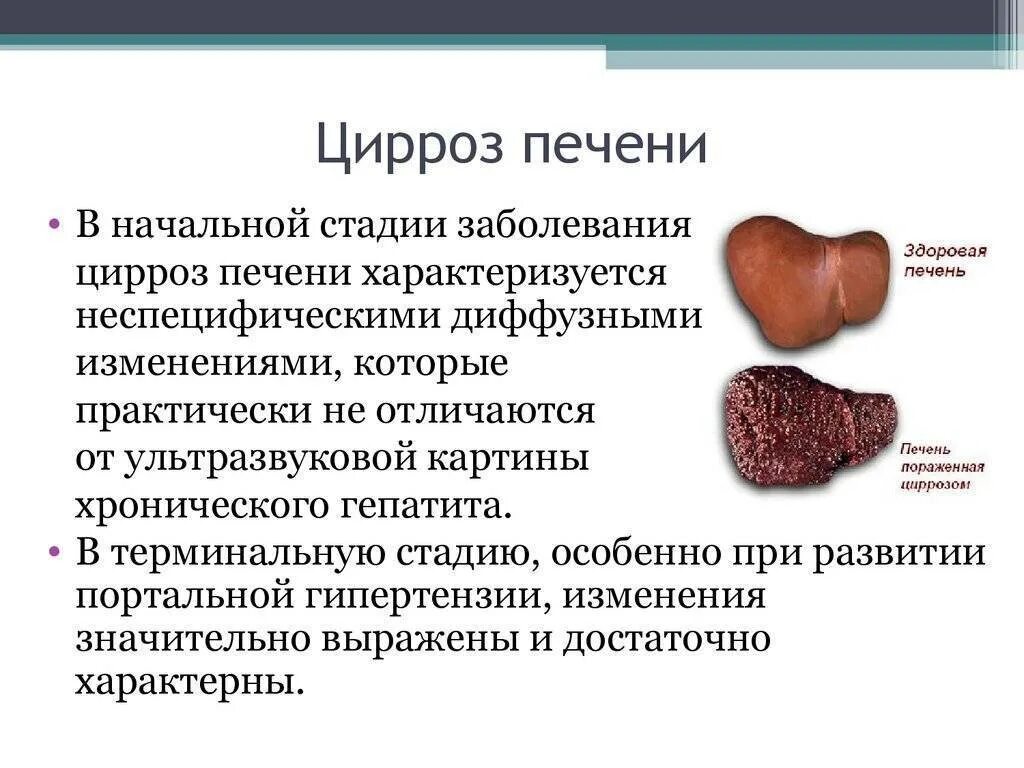 Болезнь печени признаки болезни лечение. Наиболее характерными признаками цирроза печени являются:. Стадии поражения цирроза печени. Этапы заболевание цирроза печени. Причины развития цирроза печени.