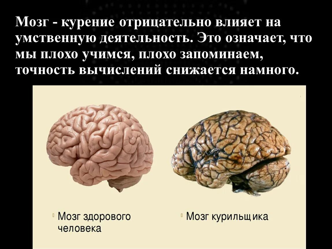 Почему мозг хуже. Мозг курильщика и здорового. Мозг курильщика и здорового человека. Здоровый мозгмозг человека.