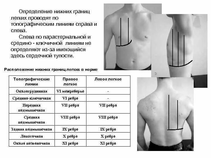 Топографические линии грудной клетки таблица. Определение нижних границ легких перкуссия. Топографическая перкуссия лёгких нижние границы. Топографическая перкуссия легких топографические линии. Границы легких определяются