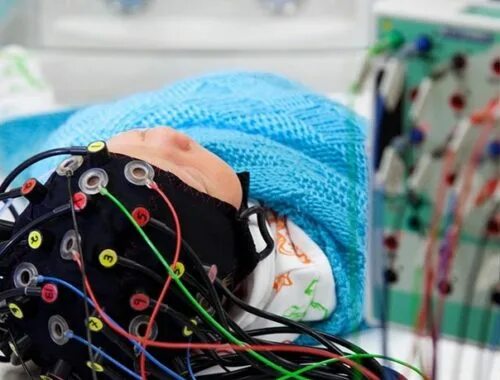 Ээг 4х часовой видеомониторинг. Ээг мониторинг ночного сна у детей. Ээг головного мозга видеомониторинг. Ээг видеомониторинг дневного сна. Ээг видеомониторинг дневного сна.