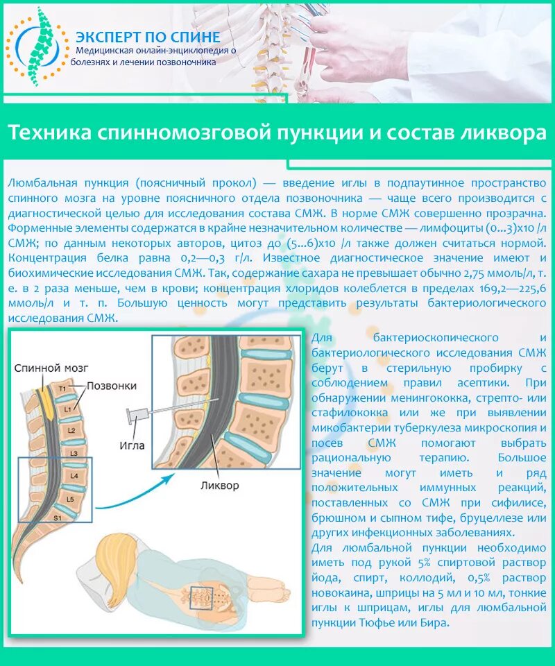 Спинномозговая пункция проводится для диагностики. Люмбальная пункция СМЖ. Положение при люмбальной пункции. Поясничная пункция техника проведения.