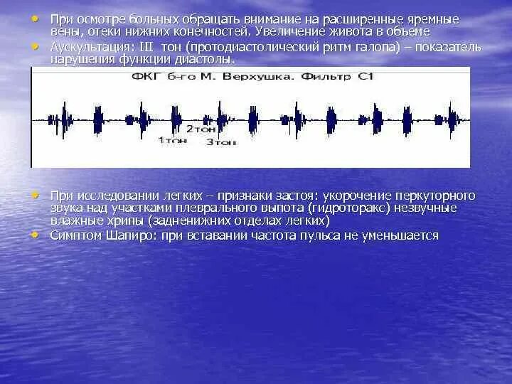 Ритм галопа при каком заболевании. Ритм галопа при каком заболевании