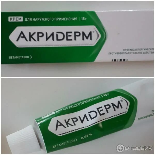 Акридерм мазь поможет от прыщей. Акридерм мазь поможет от прыщей