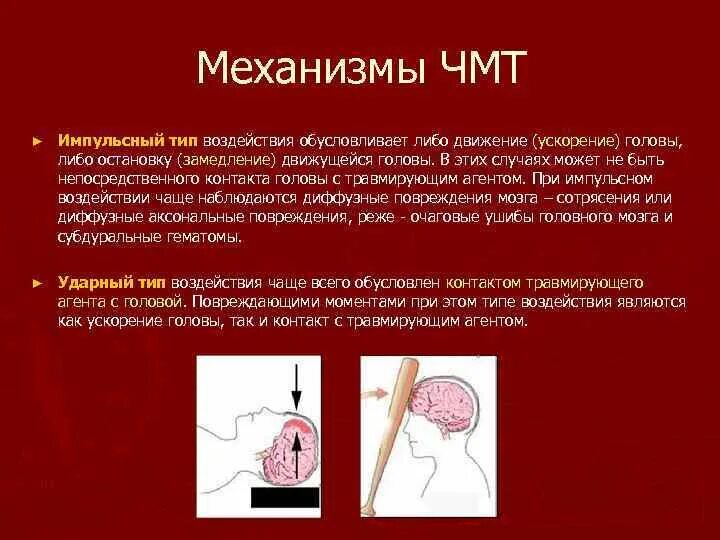 Механизм черепно-мозговой травмы. Ушиб мозга механизм повреждения. Механизм получения ЧМТ. Черепно мозговые операции