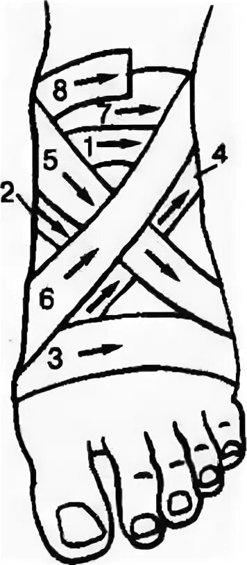Крестообразная повязка на голеностопный сустав алгоритм. 8 Образная повязка на голеностопный сустав. Восьмиобразная повязка на сустав. Крестообразная (восьмиобразная) повязка на кисть.