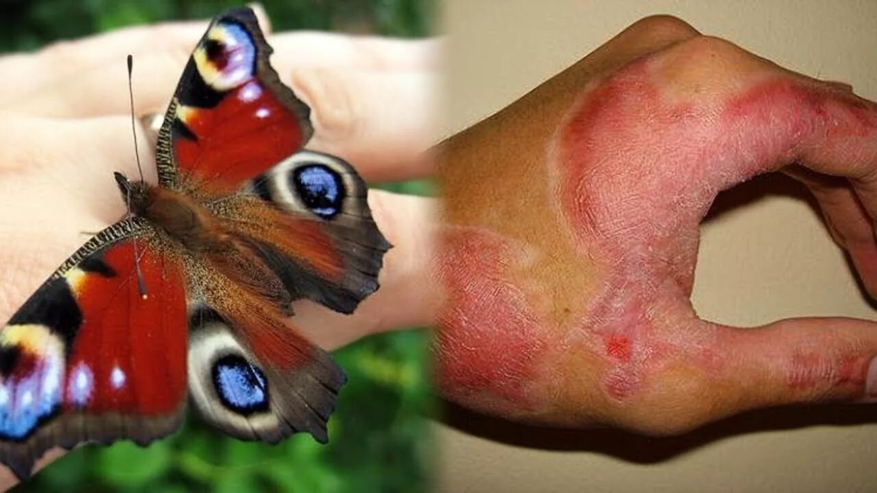 Показать видео какие бывают. Самая ядовитая бабочка. Бабочки которые кусаются.