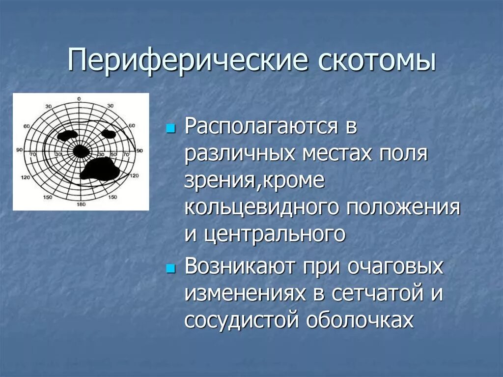 Периферическая скотома. Скотомы полей зрения. Периферическая скотома в поле зрения. Патологические скотомы.