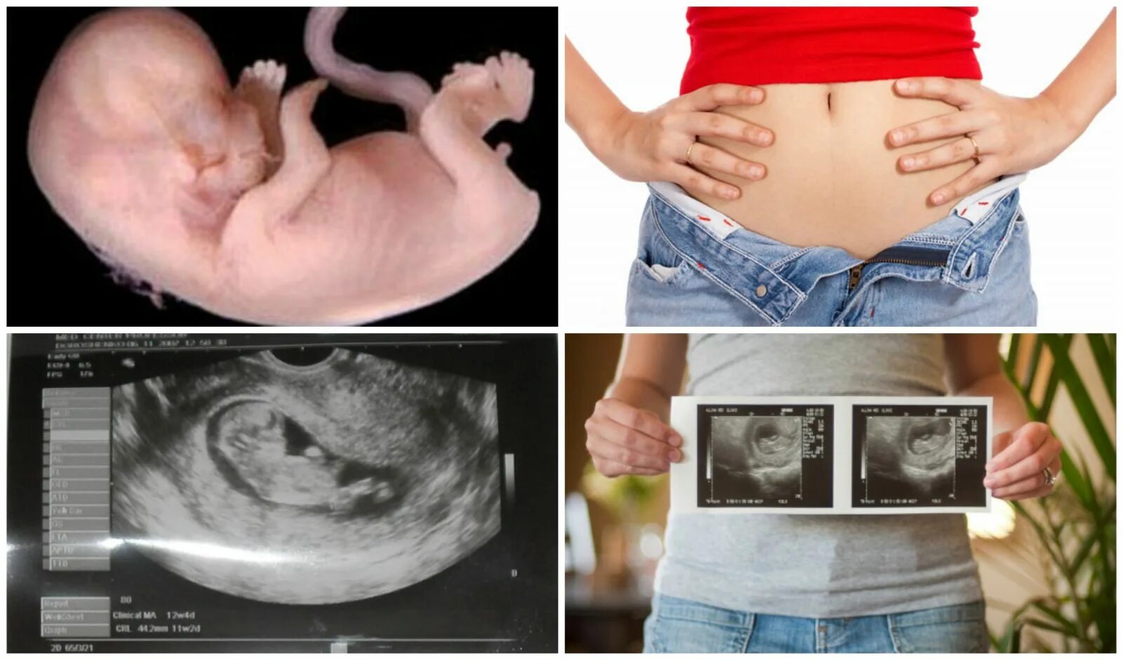 Малыш на 11 неделе беременности скрининг. УЗИ на 11 неделе беременности скрининг. УЗИ плода на 11 неделе беременности. УЗИ малыша 11 недель. 11 неделя 6 день