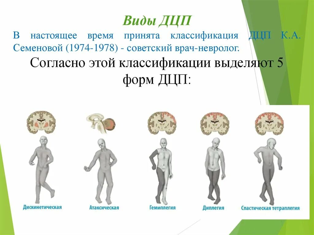 ДЦП формы классификация. Классификация ДЦП: спастическая диплегия. Формы ДЦП по классификации. Классификация детского церебрального. Тест на дцп