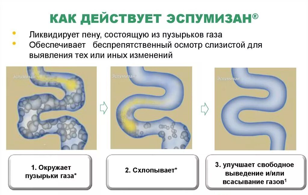 Как очистить кишечник от газов. Как действует эспумизан. Газовые пузырьки в кишечнике. Процесс образования газов в кишечнике.