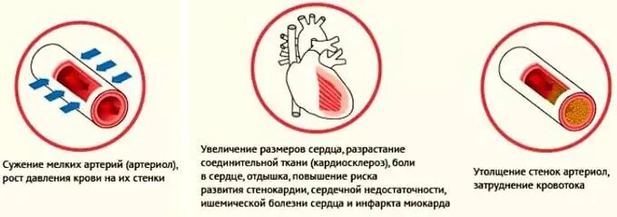 Повышение давления боли в сердце