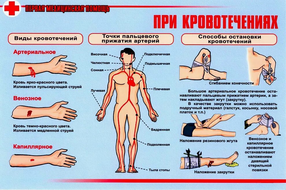 Как остановить сильную кровь. Порядок оказания первой помощи при кровотечениях. ПМП при артериальном кровотечении. Кровотечения. Раны. Классификация. Первая помощь.. Оказание первой помощи при артериальном и венозном кровотечении.