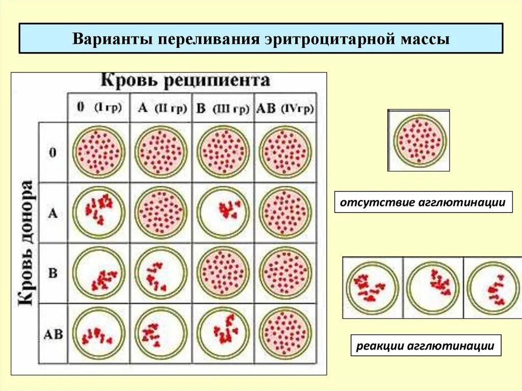 Реакция агглютинации эритроцитов. Таблица агглютинации групп крови. Схема реакции агглютинации группы крови. Схема переливания крови агглютинация. Агглютинация эритроцитов физиология.