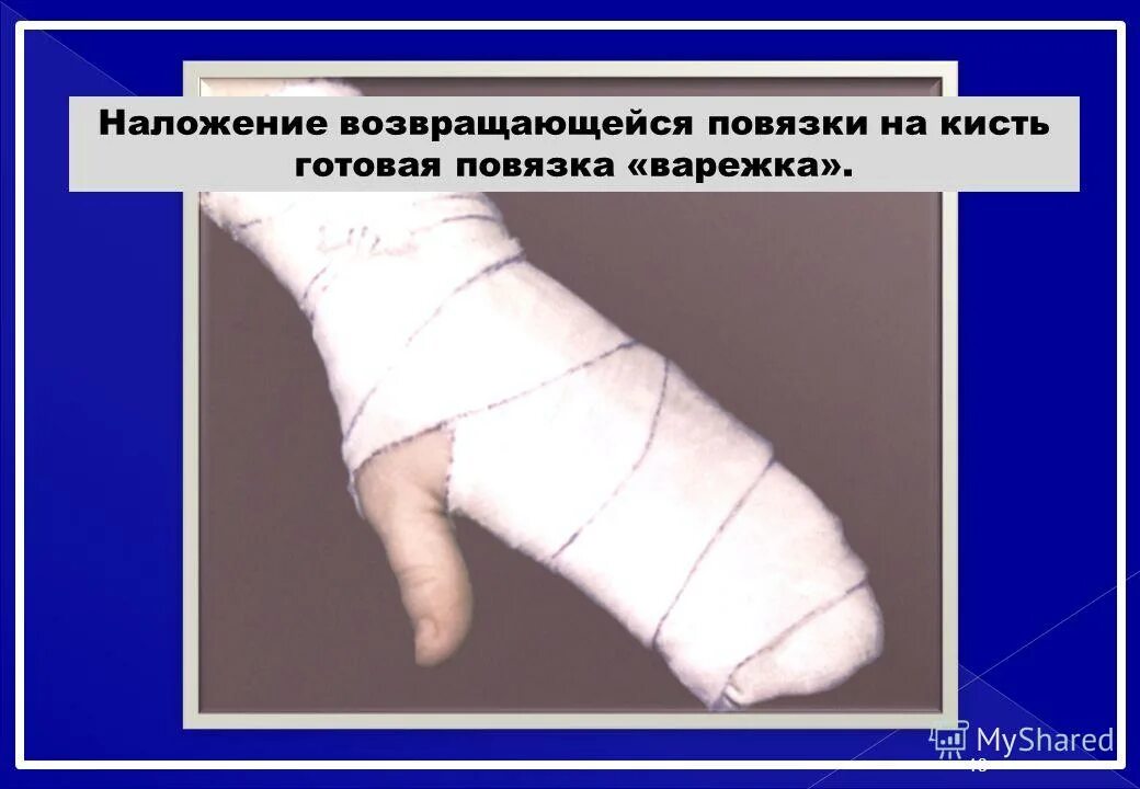 Техника наложения повязки на кисть. Колосовидная повязка на 1 палец. Техника наложения спиральной повязки на предплечье. Мягкие бинтовые повязки. Спиральная повязка на конечность.