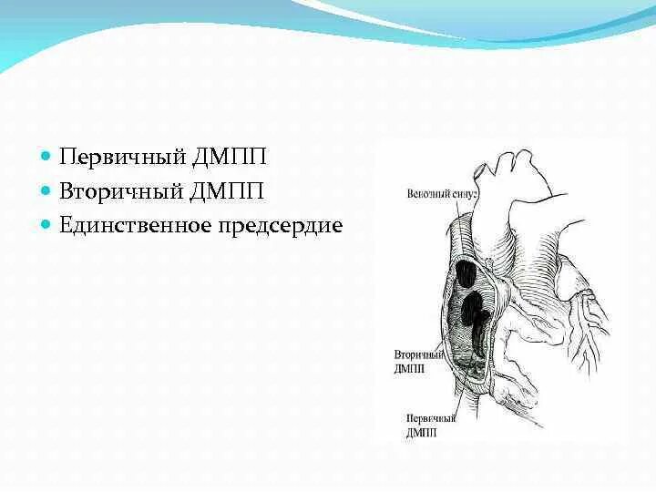 Дефект мпп. Первичный и вторичный дефект межпредсердной перегородки разница. первичный дефект межпредсердной перегородки. дефект межпредсердной перегородки классификация. вторичный центральный дефект мпп.