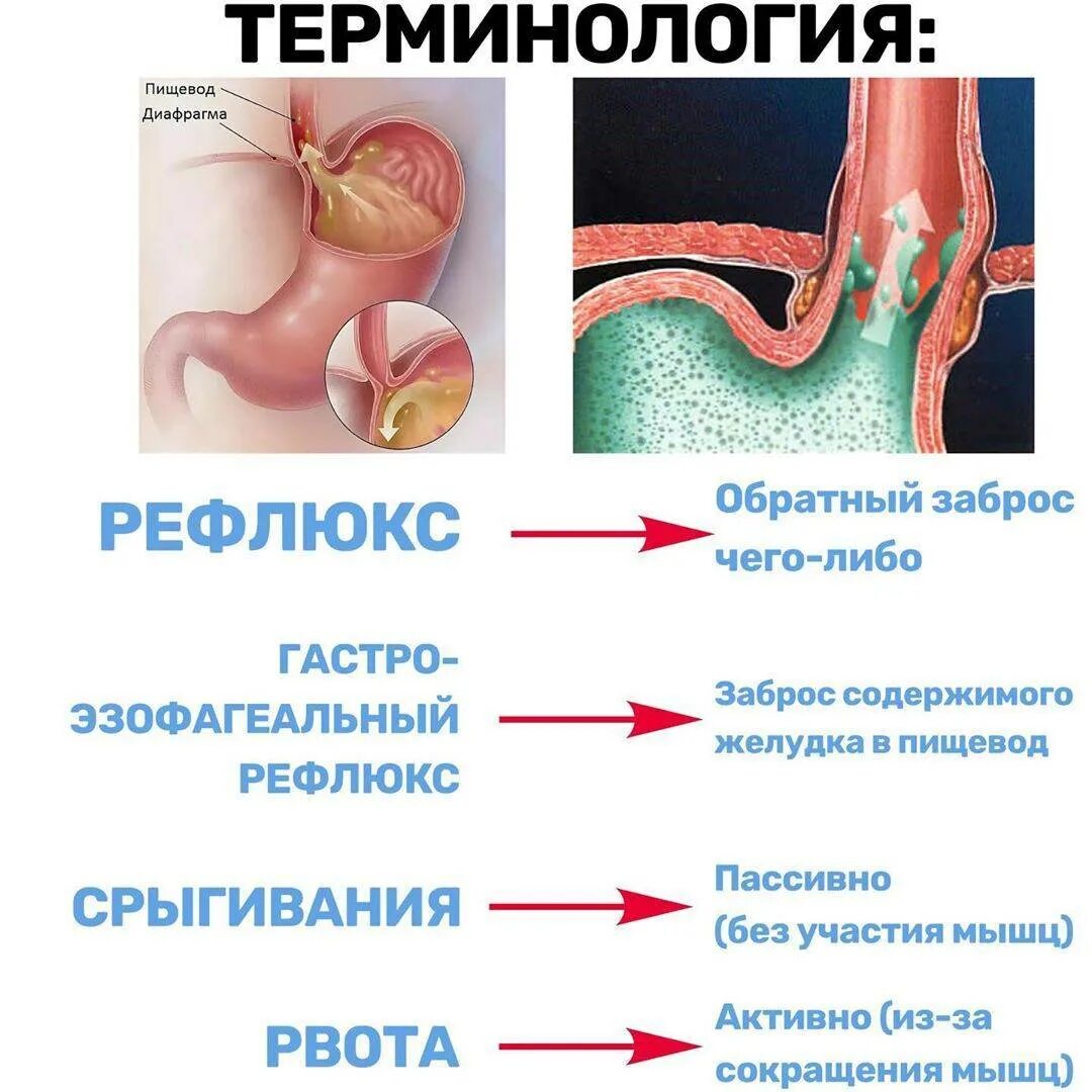 Рефлекс эзофагит. Гастроэзофагеальный (желудочно-пищеводный) рефлюкс. рефлюкс эзофагит слюноотделение. гастроэзофагеальный рефлекс. гастро-эзофагального рефлюкса.