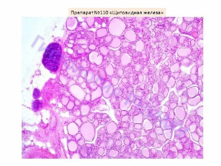 Срез щитовидной железы. Щитовидная железа гистопрепарат. Щитовидная железа гистология препарат. Паращитовидная железа гистология. Околощитовидная железа гистология.