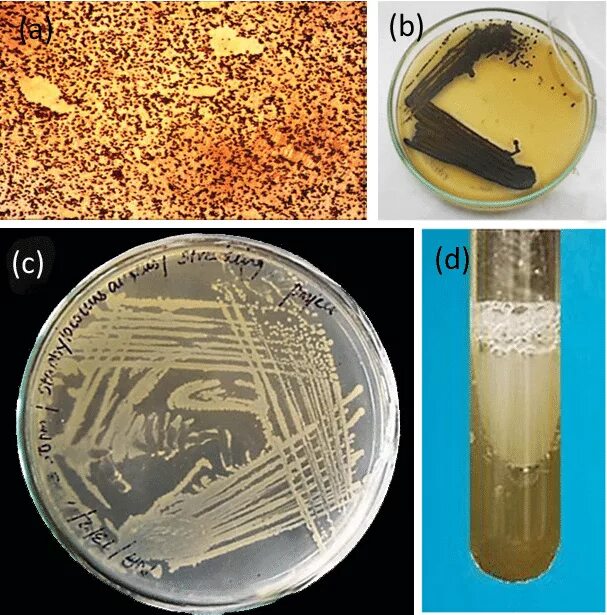 Бактерии в жидкой среде. Агар Байрд Паркера. Рост стафилококков на МПБ. Золотистый стафилококк на агаре. Пигменты бактерий Staphylococcus aureus.