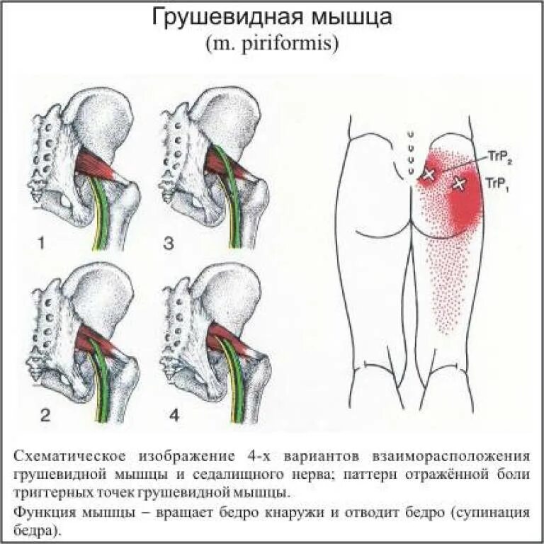 Сильная боль в ягодице