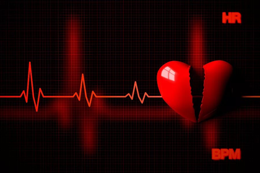 Пульс остановился. Кардиограмма сердца. Пульс остановка сердца. Сердце остановилось.
