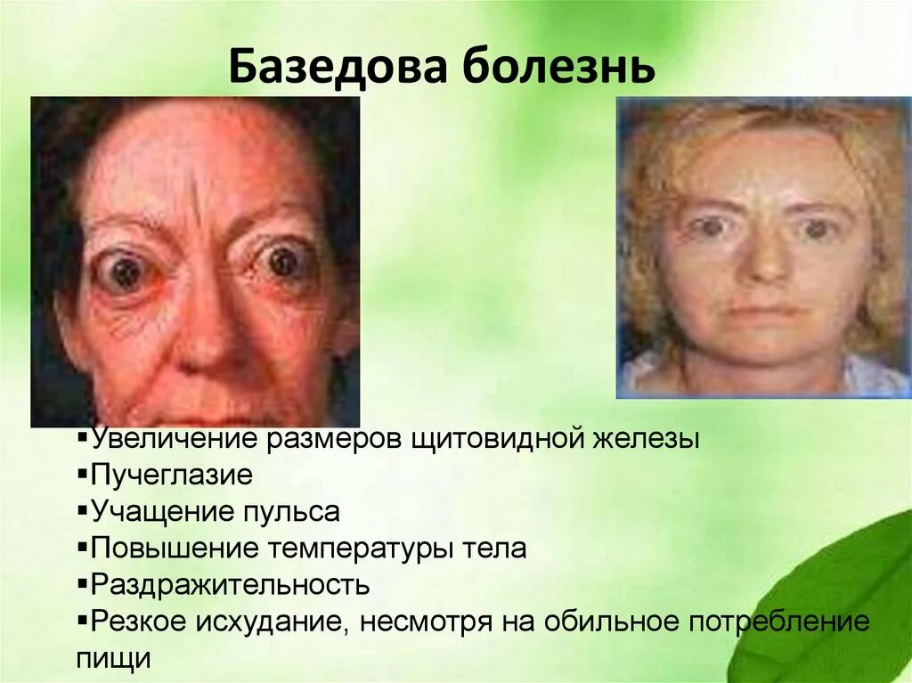 Увеличение заболеваний