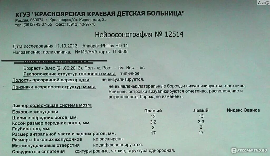 Узи мозга норма. Ультразвуковое исследование головного мозга - нейросонография (НСГ). Нейросонография головного мозга грудничка норма. Показатели УЗИ У младенцев норма головного мозга. Ширина передних Рогов боковых желудочков.